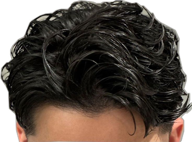 001 – Topical Anti-Dandruff & Antifungal Shampoo